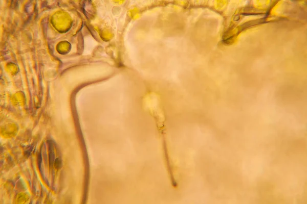 Vue Microscopique Organismes Dans Eau Bouillante Avec Végétation Pourrie — Photo