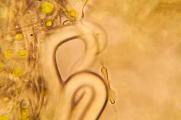 Mikroskopischer Blick Auf Organismen Verschwommenen Wasser Mit Verrotteter Vegetation — Stockfoto