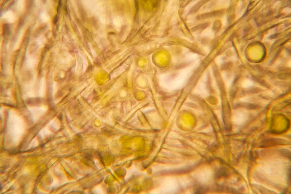 Σάπια Φύλλα Στο Μικροσκόπιο — Φωτογραφία Αρχείου