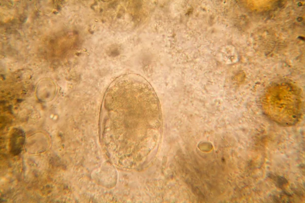 Mikroskopischer Blick Auf Organismen Verschwommenen Wasser Mit Verrotteter Vegetation — Stockfoto