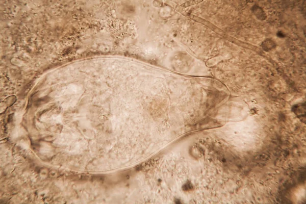 发霉水中有机物的显微观察 — 图库照片