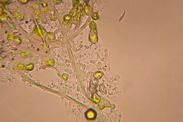 Foglie Marce Microscopio — Foto Stock