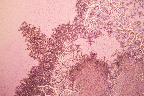 Drożdże Mikroskopie — Zdjęcie stockowe