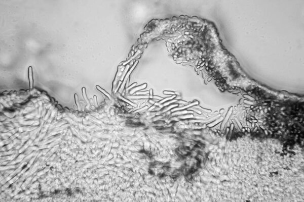 Mold at the microscope