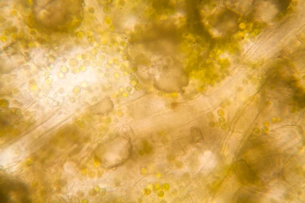 Hojas Podridas Microscopio — Foto de Stock