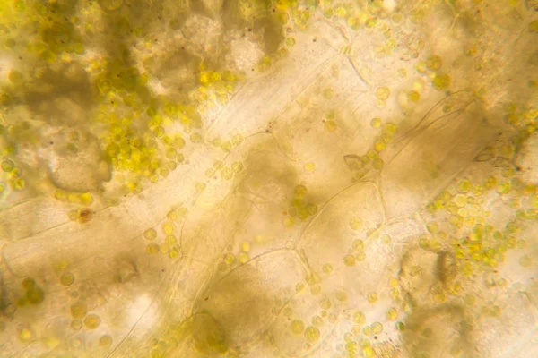Гнилые Листья Микроскопом — стоковое фото