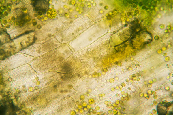 Гнилые листья под микроскопом
