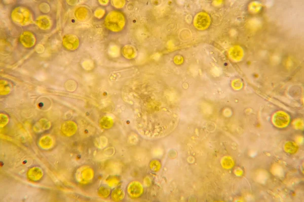 顕微鏡で腐った葉 — ストック写真