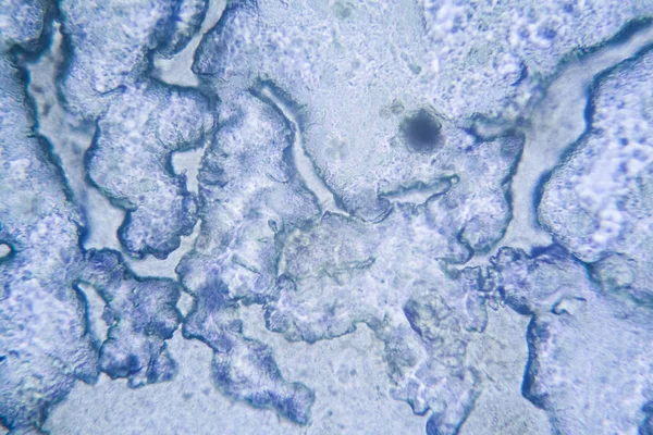 Mikroskopischer Blick Auf Die Trocknung Von Schmutzwasser — Stockfoto