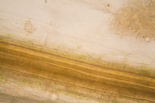 Rotten leaves at the microscope