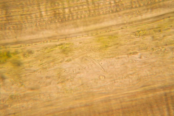 顕微鏡で腐った葉 — ストック写真