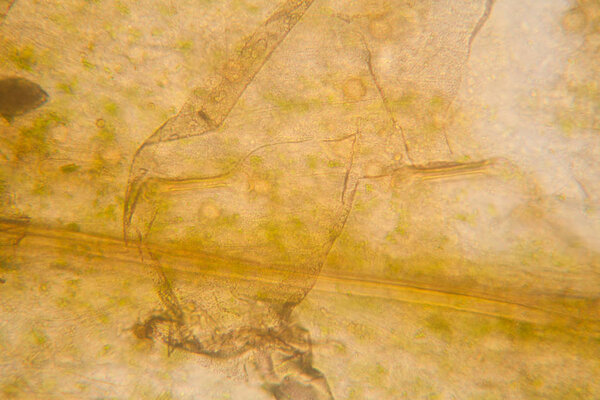 Rotten leaves at the microscope