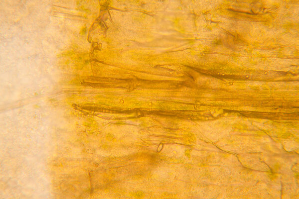 Rotten leaves at the microscope