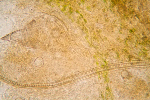 Rotte Bladeren Microscoop — Stockfoto