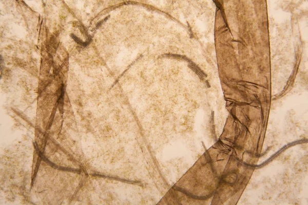 Mikroskobik görünümü ve çürük Lale kök detaylarını