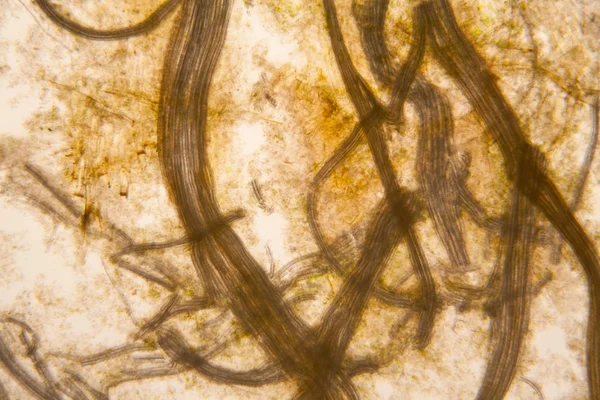 Microscopische Weergave Details Van Rotte Tulip Stengel — Stockfoto