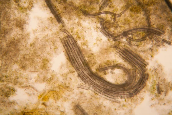 Mikroskopische Ansicht Und Details Des Morschen Tulpenstiels — Stockfoto