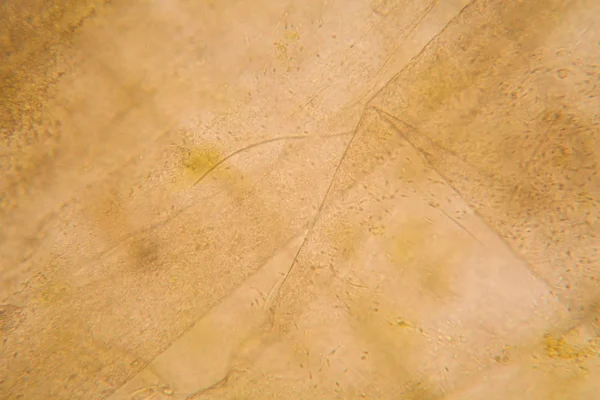 Mikroskopische Ansicht Und Details Des Morschen Tulpenstiels — Stockfoto