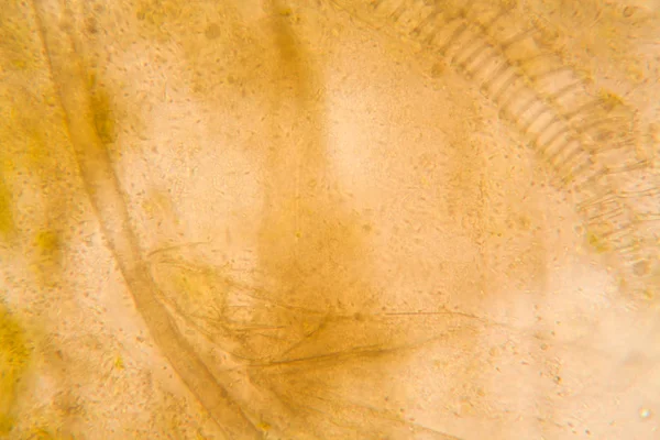 Mikroszkópos Nézet Részletek Rothadt Tulip Szár — Stock Fotó