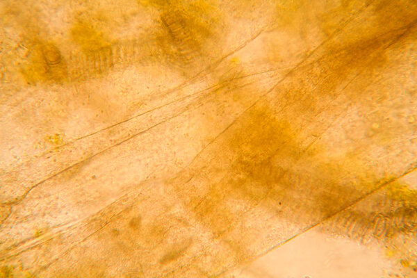 Microscopic view and details of rotten tulip stem