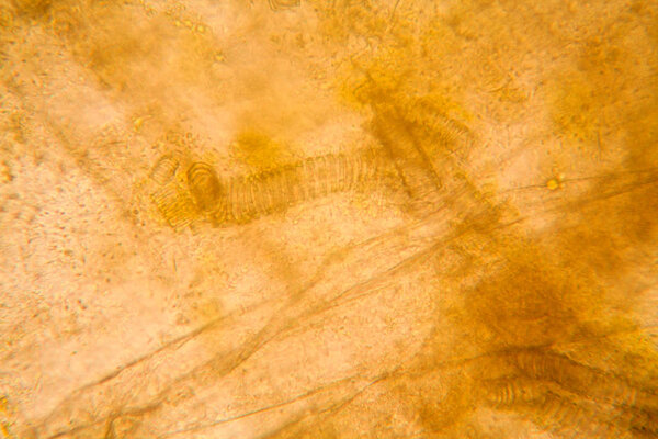 Microscopic view and details of rotten tulip stem