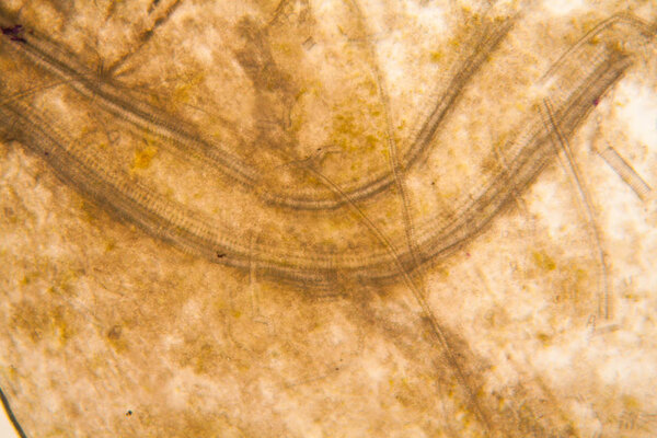 Microscopic view and details of rotten tulip stem