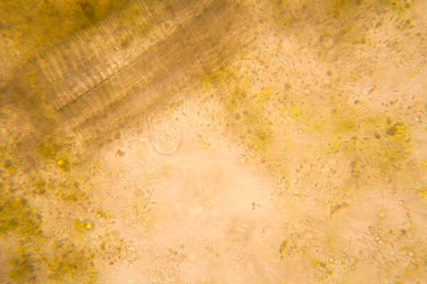 Microscopic view and details of rotten tulip stem