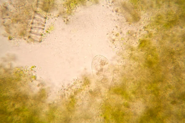 微視的立場と腐ったチューリップの茎の詳細 — ストック写真