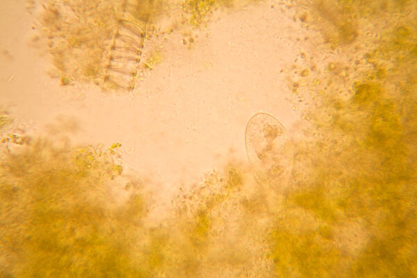 Microscopic view and details of rotten tulip stem