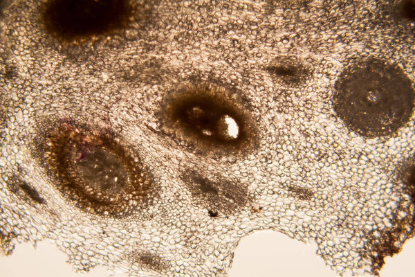 onion root cells at the microscope