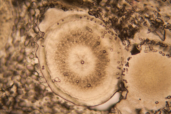 onion root cells at the microscope