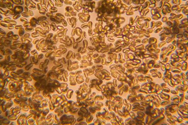 Aspergillus: imágenes, fotos de stock libres de derechos | Depositphotos