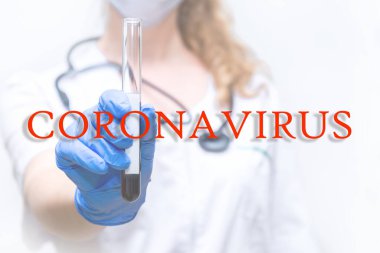 Kapatın. Kadın bir viroloğun ellerinde kan olan bir test tüpü. Laboratuvar araştırması, koronavirüs salgınına karşı aşı arayışı. Virüsün önlenmesi ve tedavisi.