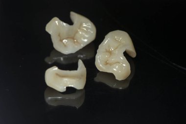 Siyah arkaplan üzerine onlay yükle