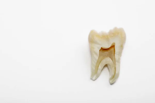 白い背景の上のヒトの歯分離オブジェクト — ストック写真