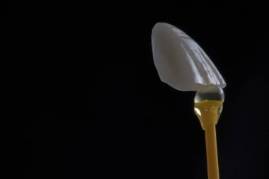  Siyah arka plan makro fotoğrafını düzeltmeden önce porselen bir Veneer
