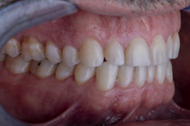 İnsan dişleri yakın çekim makro fotoğrafçılık