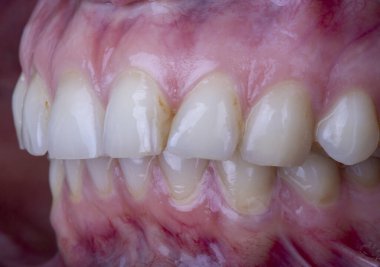 İnsan dişleri yakın çekim makro fotoğrafçılık