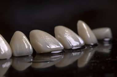 siyah zemin kaplamalı güzel porselen kaplamalar seramik porselen kaplamalar, yeni dişler, yakın çekim güzel bir gülümseme