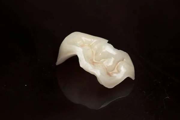 Ceramic White Tab Tooth New Teeth Beautiful Smile Close Dentistry — Stock Photo, Image