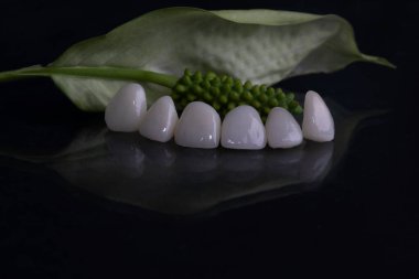 ceramic porcelain white veneers, new teeth, beautiful smile close-up clipart
