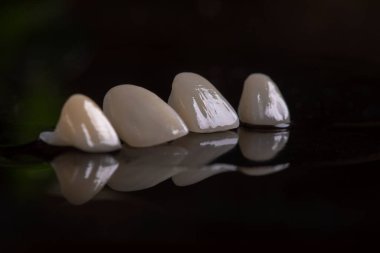 ceramic porcelain white veneers, new teeth, beautiful smile close-up clipart