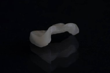 Dişte seramik beyaz şerit, yeni dişler, güzel bir gülümseme. Yakın plan. Dişçilik