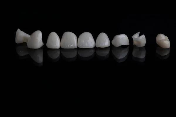 Κεραμική Πορσελάνη Λευκό Καπλαμά Νέα Δόντια Όμορφο Χαμόγελο Close — Φωτογραφία Αρχείου