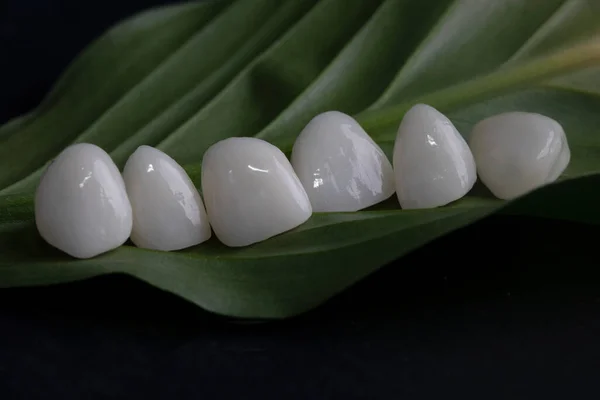 Ceramic Porselen Putih Veneers Gigi Baru Senyum Indah Close — Stok Foto