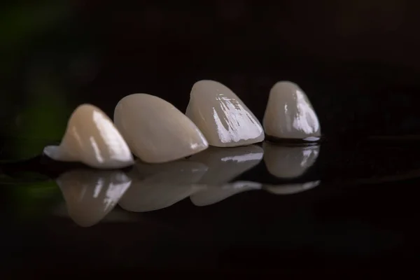 Porcelanowe Białe Okleiny Ceramiczne Nowe Zęby Piękny Uśmiech Bliska — Zdjęcie stockowe