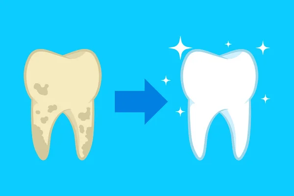 Vector illstration of teeth cleaning concept. Flat design. Isolated. — 스톡 벡터