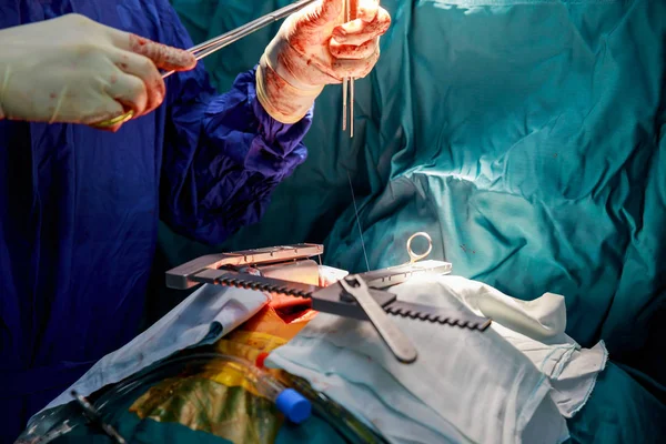 Cirugía de bypass cardiaco a corazón abierto en sala de operaciones — Foto de Stock