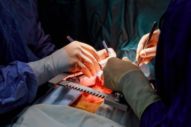 Açık kalp üzerinde bir işlem sırasında cerrah