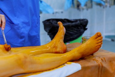 Hemşire ve doktor hasta ameliyat Oda antiseptik çözüm cilt üzerinde cerrahi hasta hazır hazırlamak
